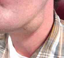 Adenomul glandei salivare: cauze, simptome și metode de tratament