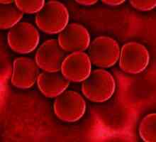 Aglutinarea sangvină este ... Grupele de sânge și reacțiile de aglutinare