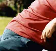 Alimentare obezită (obezitate constituțională exogenă): principalele cauze