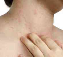Alergia la nivelul gâtului: cauze la adulți și copii