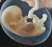 Amnion este una dintre membranele embrionare ale embrionilor de reptile, păsări, mamifere