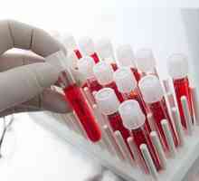 Test de sânge pentru cancer. Este posibilă determinarea cancerului prin analiza sângelui?