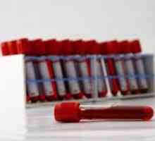 Test de sânge la un copil: decodare - poți să-l faci singur?