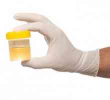 Analiza urinei de către Nechiporenko. Cum se asamblează corect?