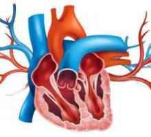 Aorta este compactată - ce înseamnă? Tratamentul compactiilor aortice