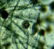 Bacteriile și microbii sub microscop (foto)