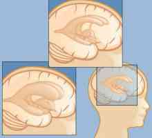 Boli ale capului: nume și simptome