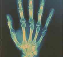 Durerea mâinii: cauzele, simptomele, tratamentul