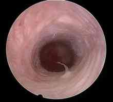 Canalul de col uterin - ce este și care sunt funcțiile sale?