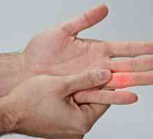Ce să faceți dacă ați scos degetul: simptome, prim ajutor