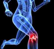 Ce este artroza deformată a articulației genunchiului?