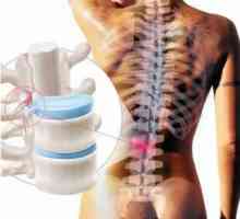 Modificări degenerative și distrofice ale coloanei vertebrale lombare: cauze și simptome