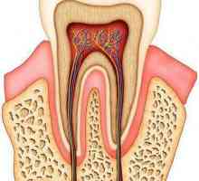 Dentina - substanța osoasă a dintelui