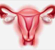 Fibroamele ovariene: simptome, cauze, tratament