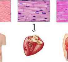 Funcții ale țesuturilor musculare, tipuri și structură