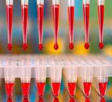 Hemoglobina în testul de sânge: denumire. Explicarea testului de sânge