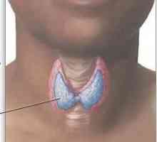 Hipotiroidismul este ceea ce?
