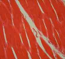 Țesutul muscular neted: caracteristicile structurii. Proprietățile țesutului muscular neted
