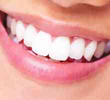 Implant sau coroană - ce este mai bine pentru dinte?