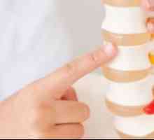 Cum se trateaza osteochondroza coloanei vertebrale cervicale. Osteocondroza secțiunii de col…