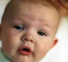 Cum să tratăm un nas curbat la un nou-născut?