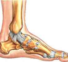 Cum să tratați întinderea ligamentului pe picior. Extinderea striurilor: tratamentul și recuperarea…