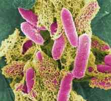 Cum se transmite Staphylococcus aureus? Grup de risc, prevenire