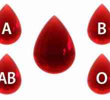 Cum se rezolvă problema pentru grupul de sânge și factorul Rh