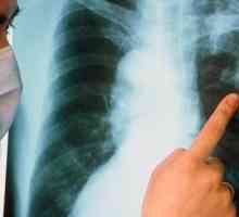 Care este cel mai important simptom al tuberculozei pulmonare?
