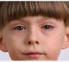 Ochii roșii la un copil: cauze, tratament și prevenire