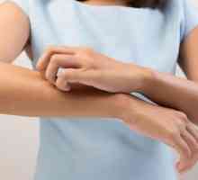 Locurile roșii pe palme și tălpile picioarelor: cauze, simptome și caracteristici de tratament