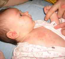 Tratamentul tamponării la nou-născuți