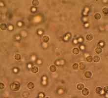 Leucocitele din urină sunt ridicate: cauze și consecințe