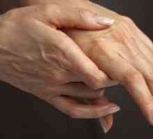 Medicament pentru articulații - tratarea artritei