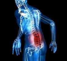 Lumbalia: Ce este? Cauze, simptome și metode de tratament a durerii lombare
