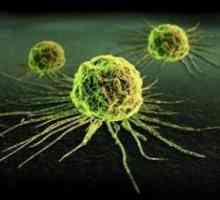 Metode de detectare a celulelor canceroase în corpul uman