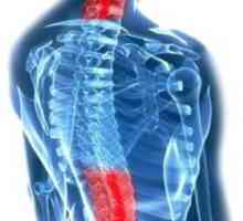 MKB: osteochondroza coloanei vertebrale. Codul bolii și descrierea