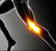 Suport pentru genunchi pentru fixarea articulației genunchiului: descriere, dimensiuni, recenzii