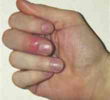 Controleaza degetul pe mana: cauze, simptome si metoda de tratament