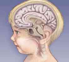Cât de grave sunt efectele meningitei la copii?