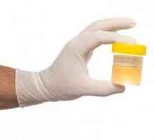 Analiza generală a urinei. Cum se colectează și se interpretează rezultatul?