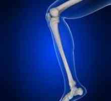 Umflarea genunchilor: cauze