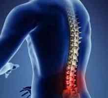 Dureri acute ale spatelui inferior: cauze și tratament