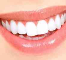 Albirea dinților fără a afecta smalțul