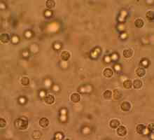 Bacteriile patogene în urină, ce înseamnă aceasta?