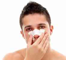 Fracturile nasului: simptomele și tratamentul acestora
