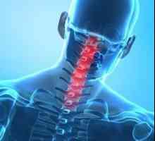 Fracturile vertebrelor cervicale: consecințe și tratament