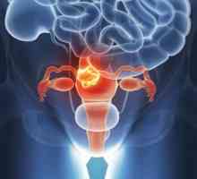 Transplantul uterin: Caracteristici, procedură și efecte