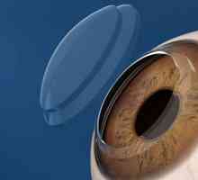 Transplantarea corneei ochiului: descriere, indicații, costuri, recenzii. Microchirurgia ochiului
