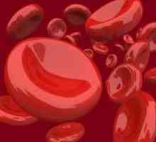 De ce este hemoglobina ridicată la femei și ce înseamnă aceasta